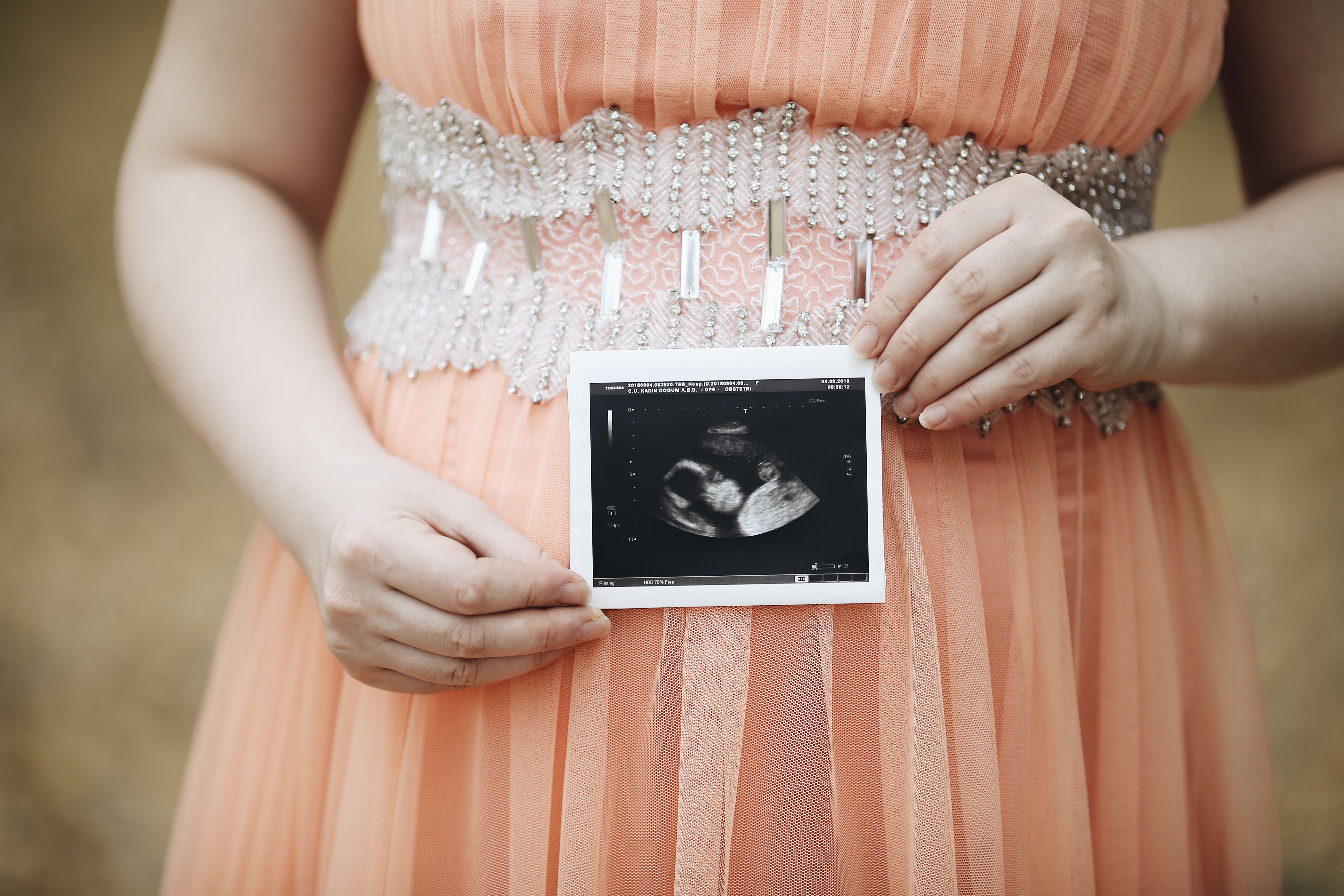 Young family near Augusta Georgia — military demographics are a core audience for keepsake elective ultrasound studios