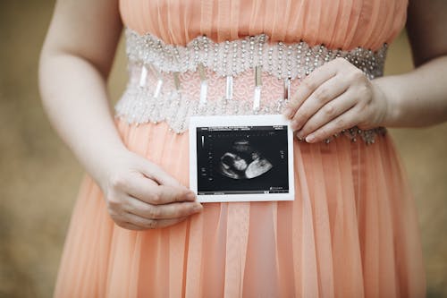 女人, 懷孕, 手 的 免費圖庫相片