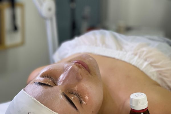 Microdermabrasion