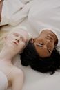 Free stock photo of affection, albino, beautiful