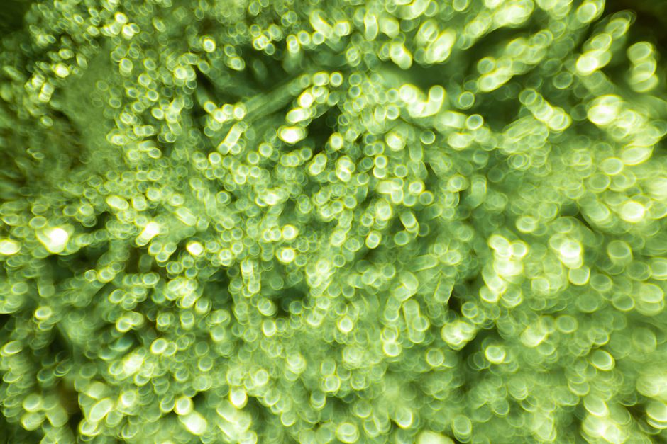 Green Glow Illuminates Possible Alzheimers Breakthrough Green Glow Illuminates Possible Alzheimers Breakthrough