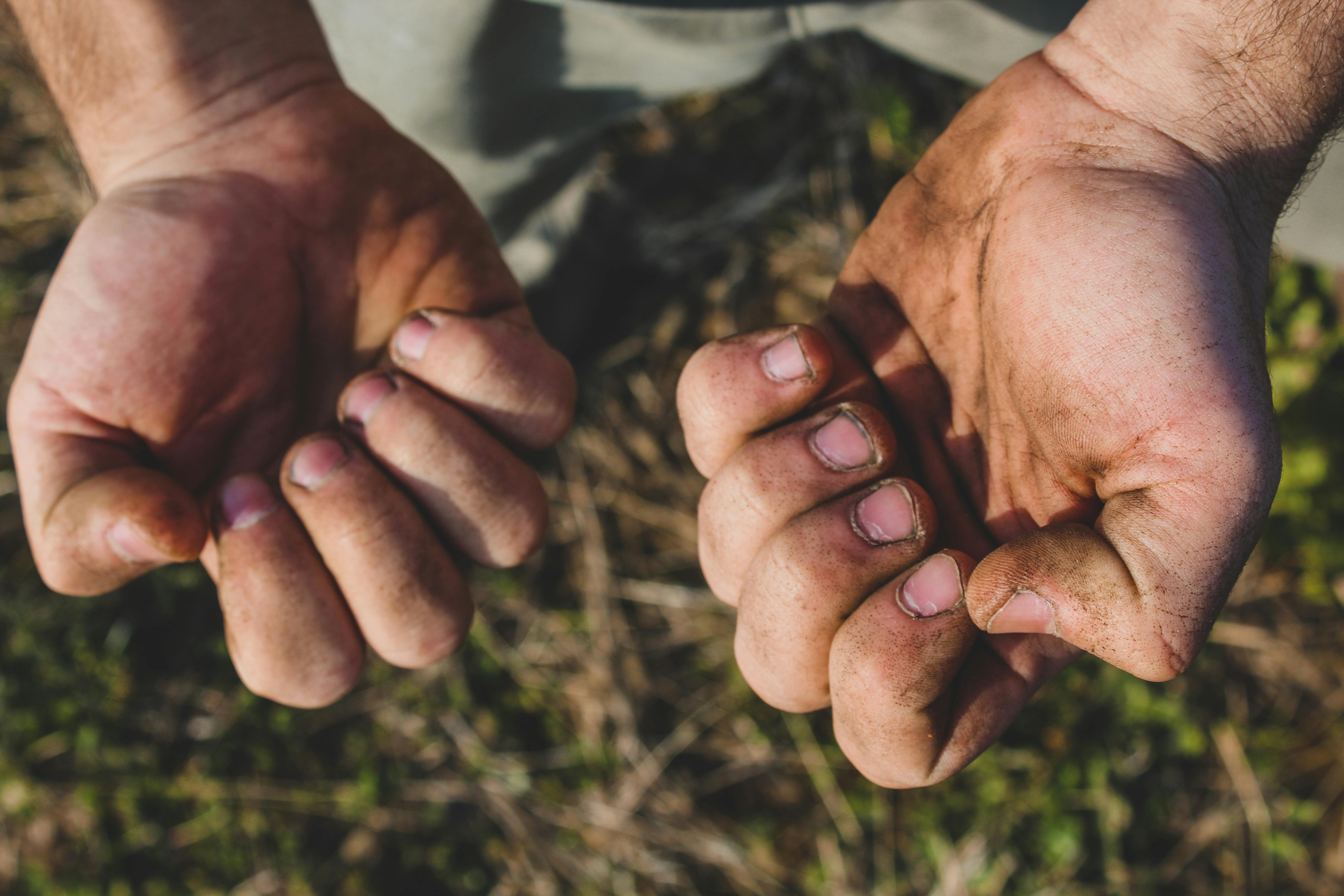Dirty Fingernails On A Mans Hands