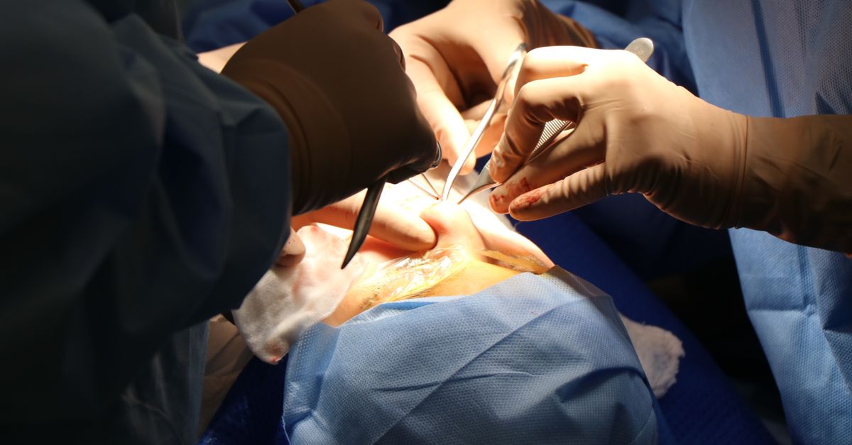New Suturing Technique Halves Surgery Time for Pediatric Hernia