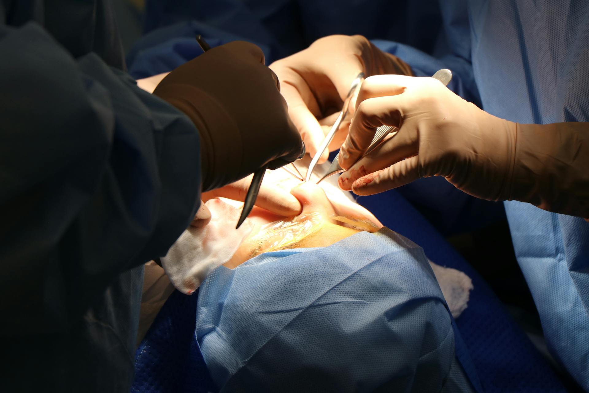 Hands in Surgical Gloves During Surgery