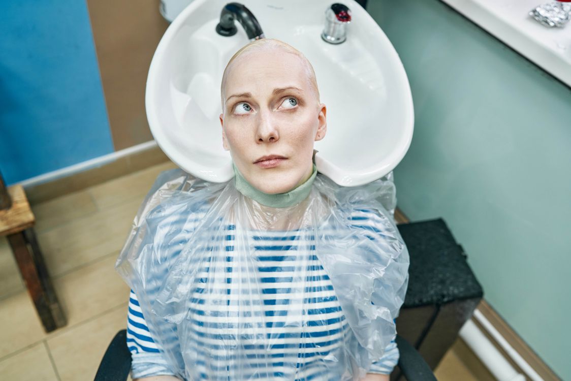 Hair transplant: Why choose hair transplant? Hair transplant: Why choose hair transplant?