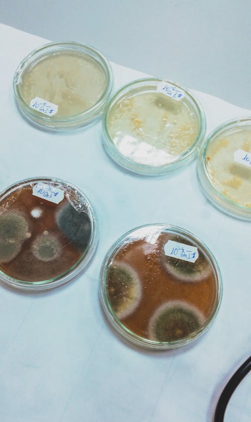 Бесплатное стоковое фото с анализ, бактерии, Биология