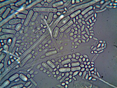 Detailed microscopic imagery of microorganisms at high magnification.