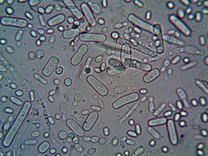Rod-shaped bacteria under a microscope