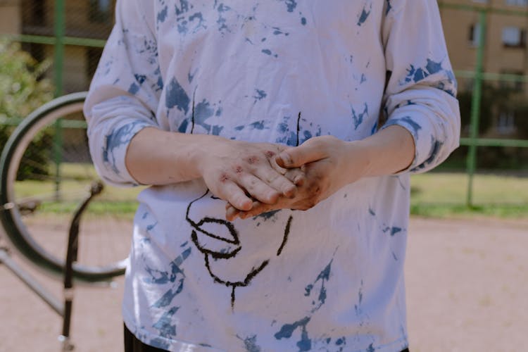 A Person With Bruised Hands