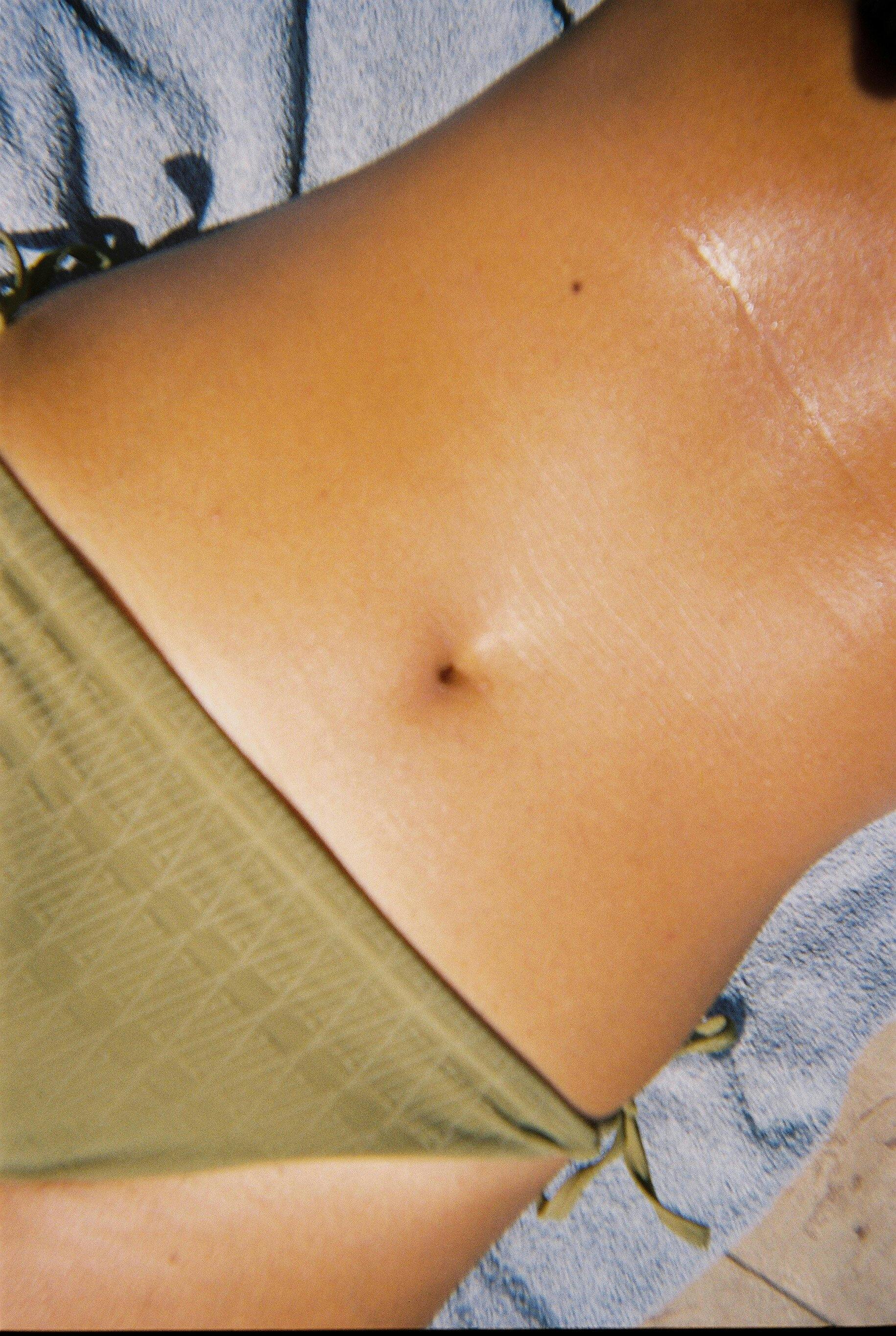 How can I tighten my loose belly skin?