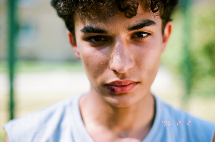 Photograph Of A Boy With A Wound On His Lip