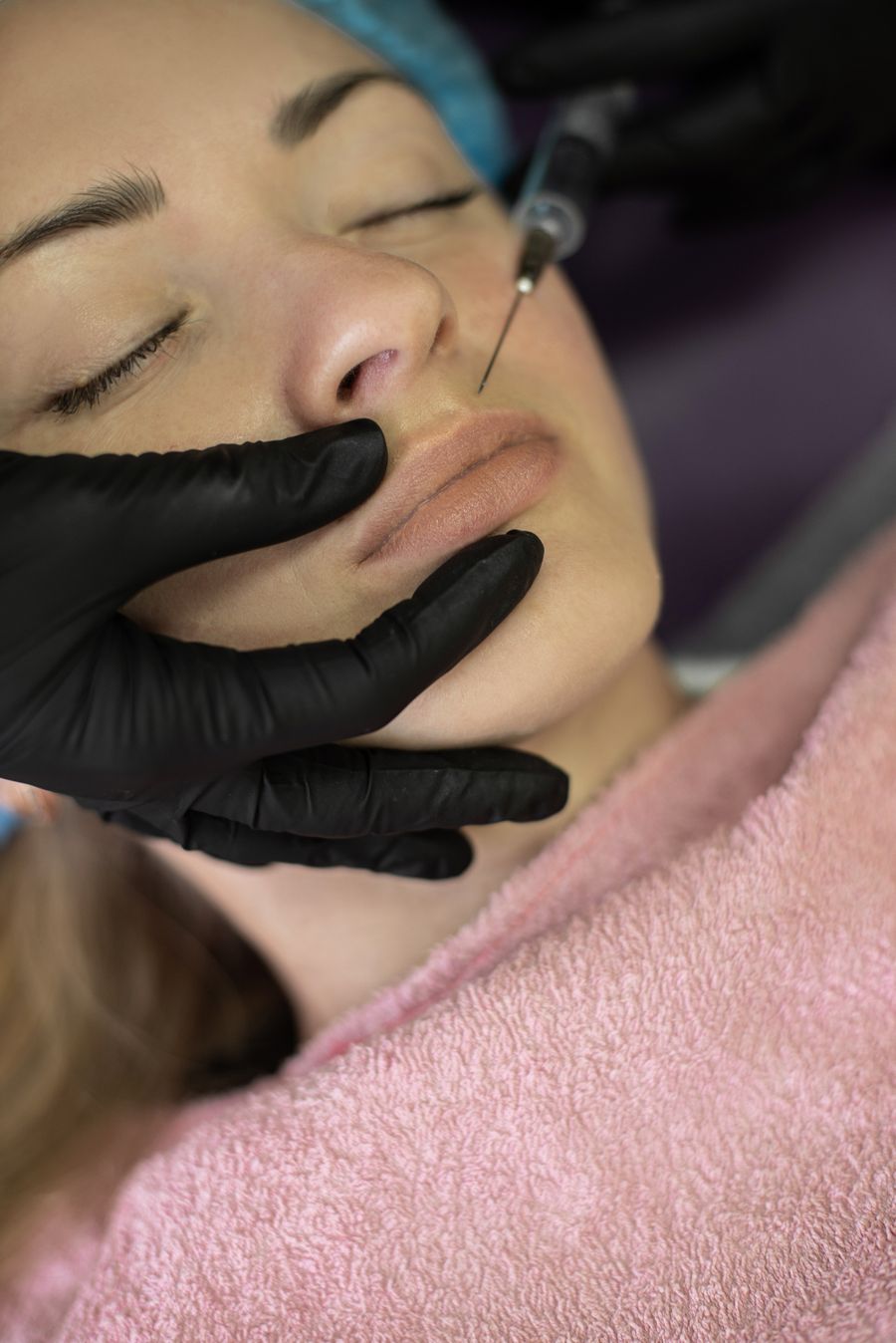 Preenchimento Labial