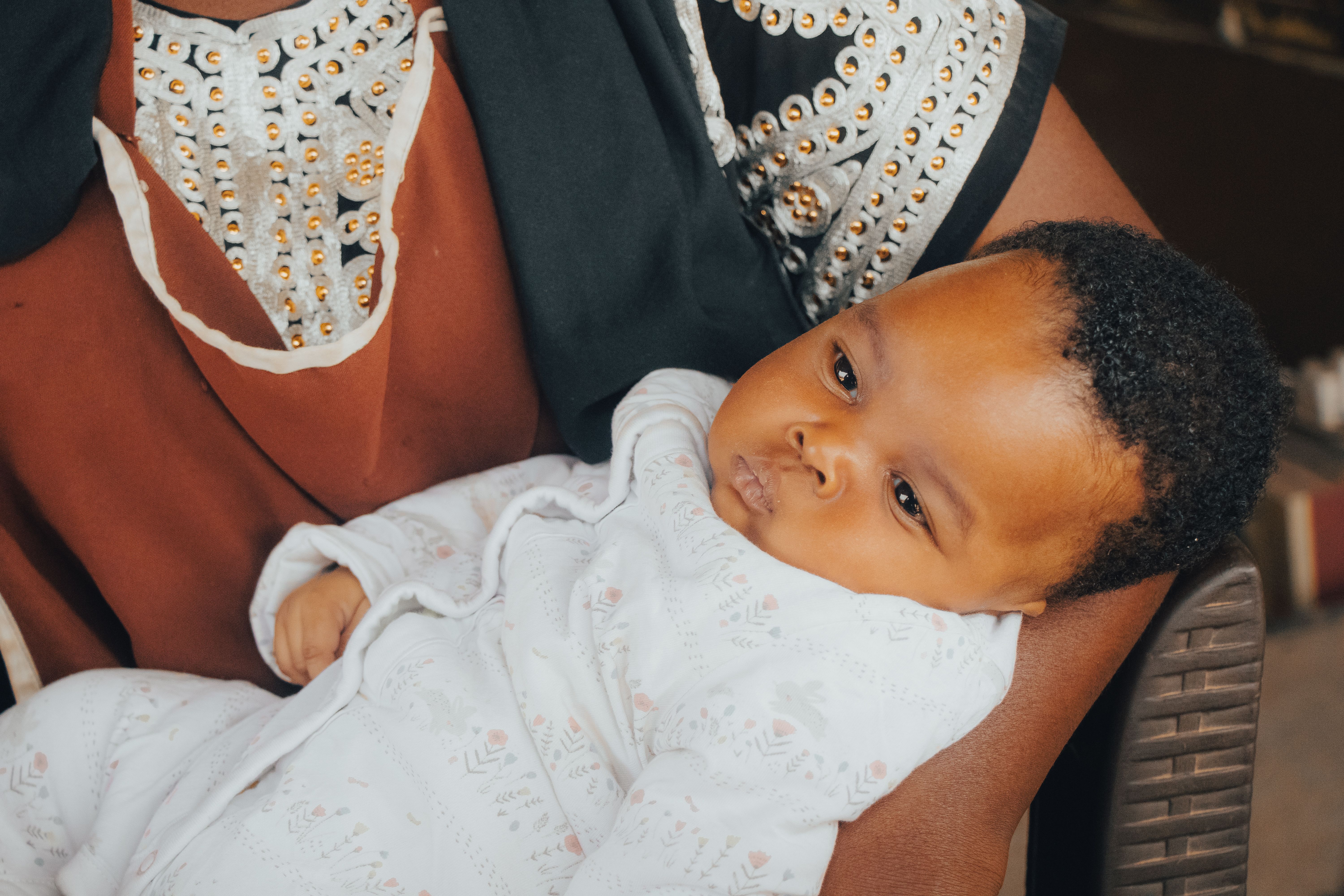 Why Newborn Skin Peels, Blotches And Alarms Parents