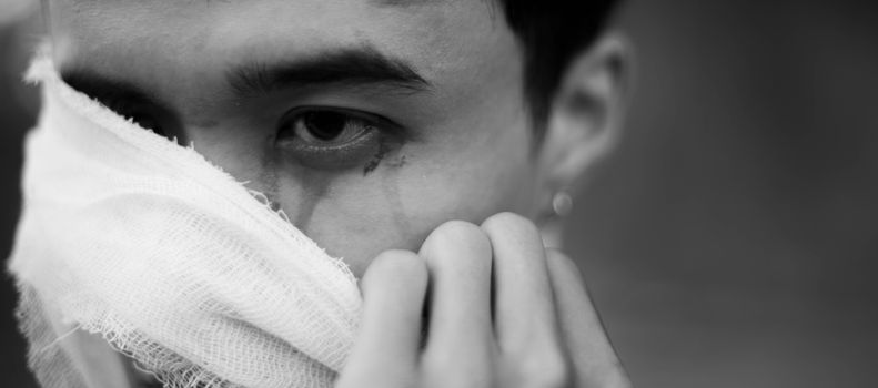 Grayscale Photo of a Person with Bandage on Face