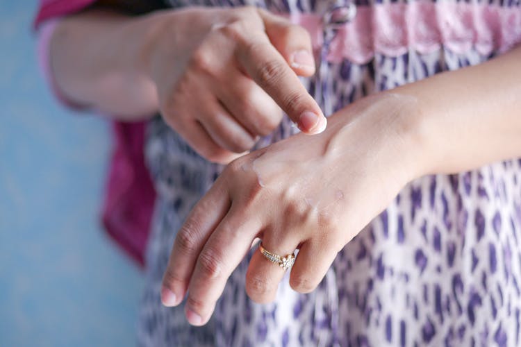 Person Putting Cream On Her Hand