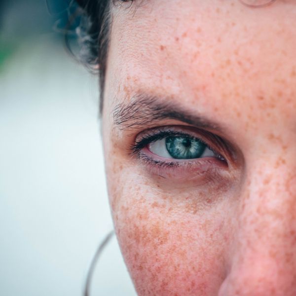 Even skin tone after treatment