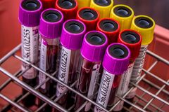 Close-up of colorful blood test tubes in a metal rack for laboratory analysis.