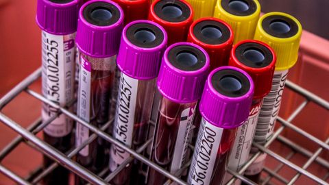 Close-up of colorful blood test tubes in a metal rack for laboratory analysis.