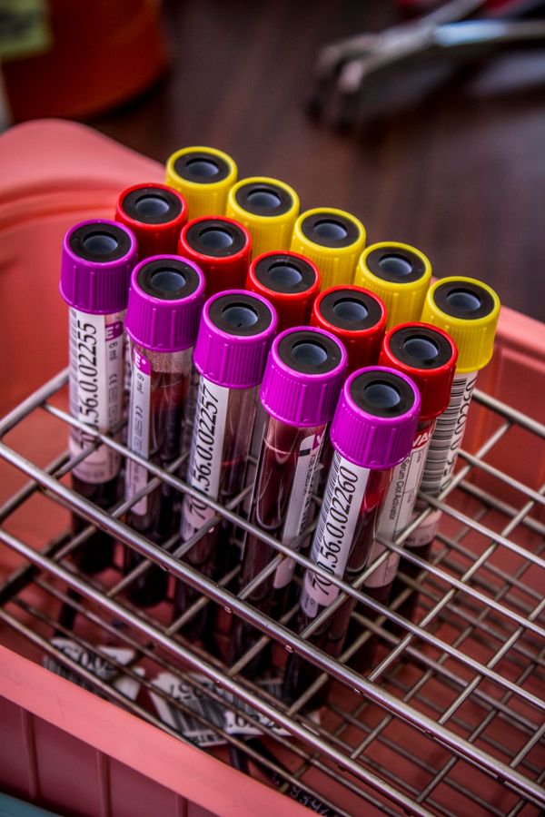 Test tubes in metal rack - aliquoting and storage