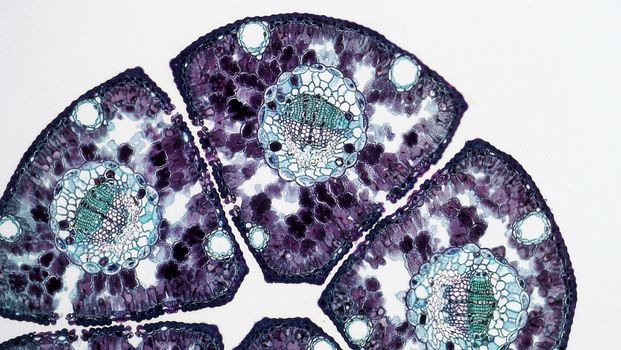 Tissue seen under Microscope