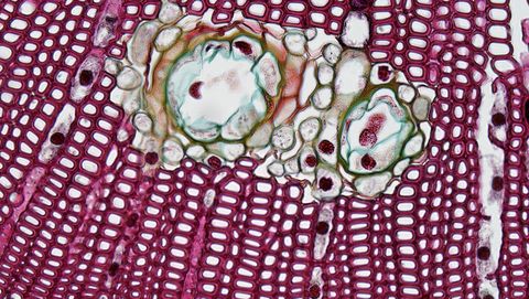 Picture for New Alzheimer's Research Targets Brain Immune Cells Instead of Protein Buildup