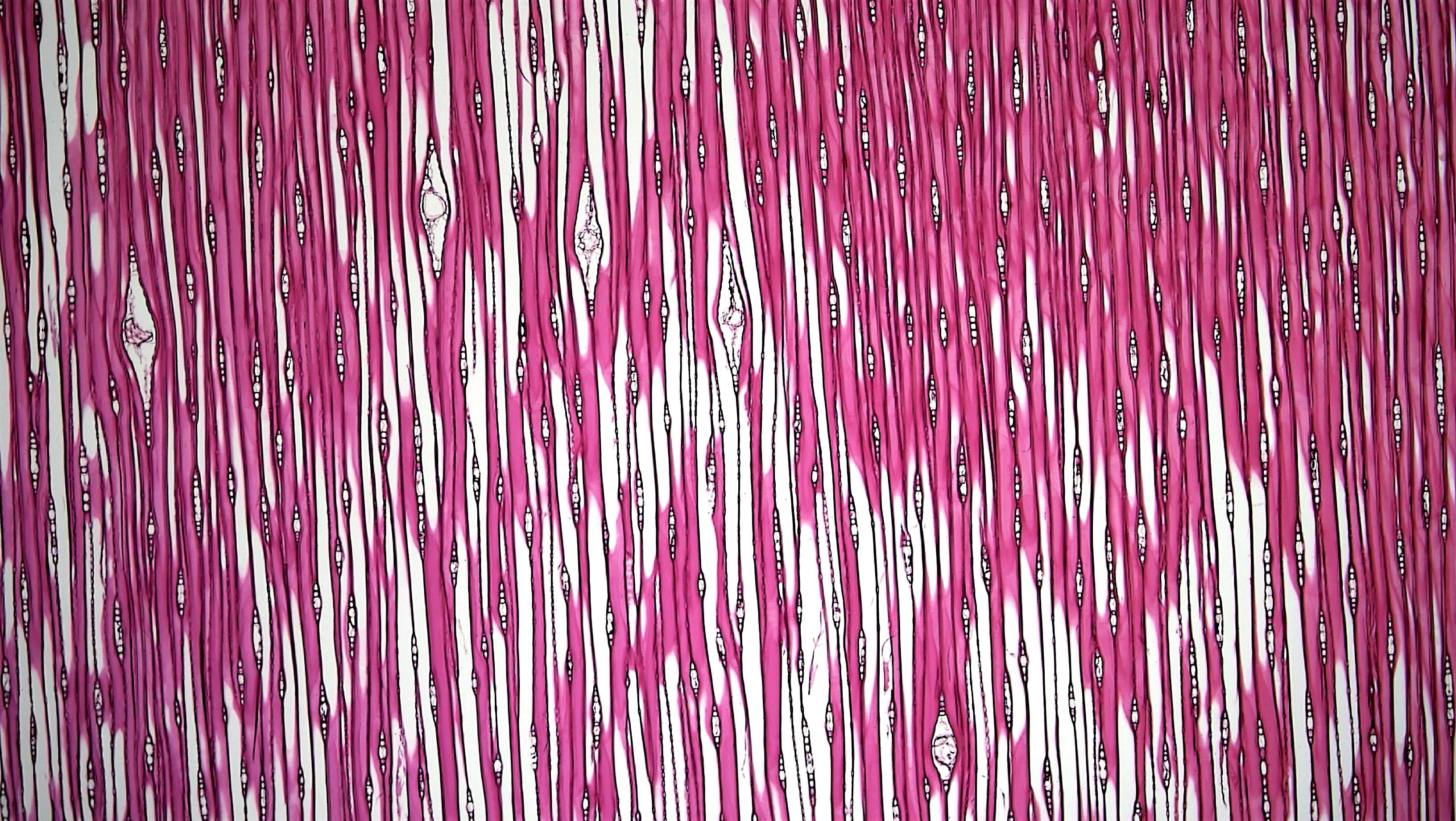 Terungkap! J&J Sembunyikan Asbes Berbahaya di Bedak Bayi Puluhan Tahun