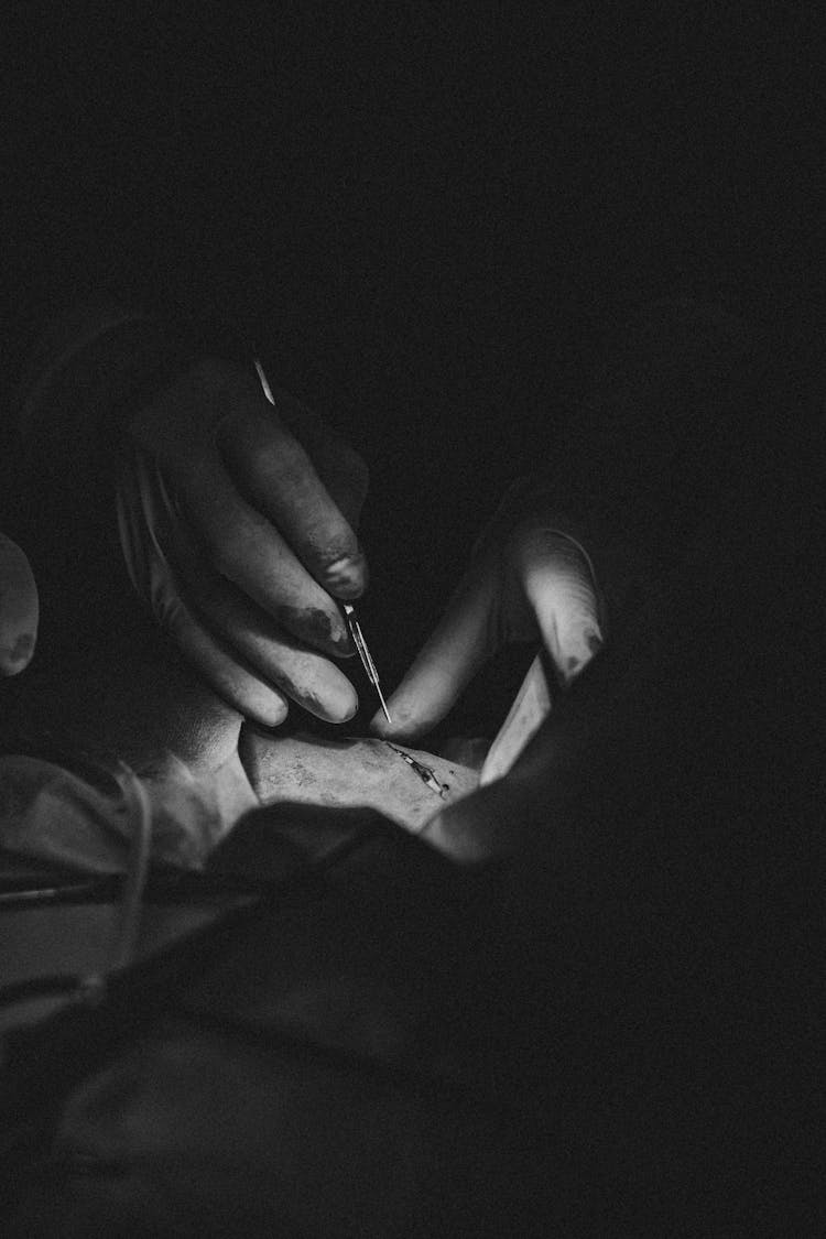 Close-up Of A Surgeon Performing A Surgery 