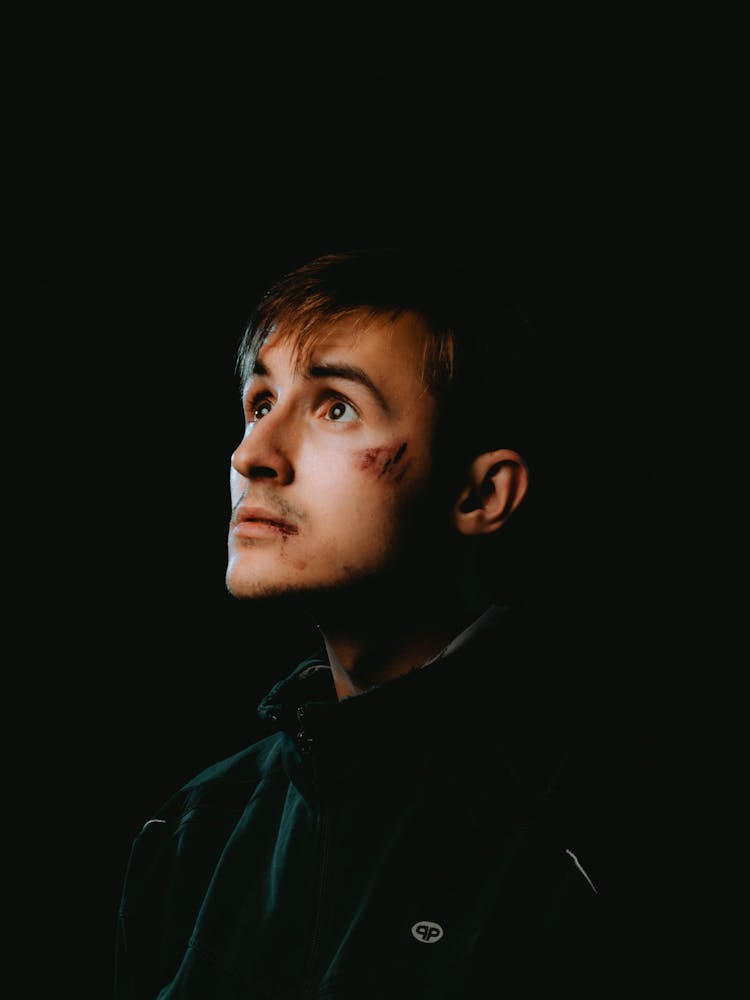 Man With Bruises On The Face Wearing A Jacket