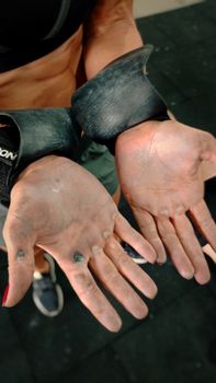 Detailed view of hands with calluses, showing strength and dedication in fitness routines.