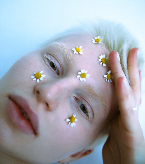 Albino Woman with Flower Heads on Her Face