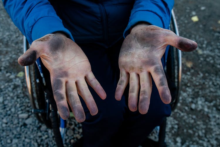 Dirty Hands Of A Person In A Wheelchair