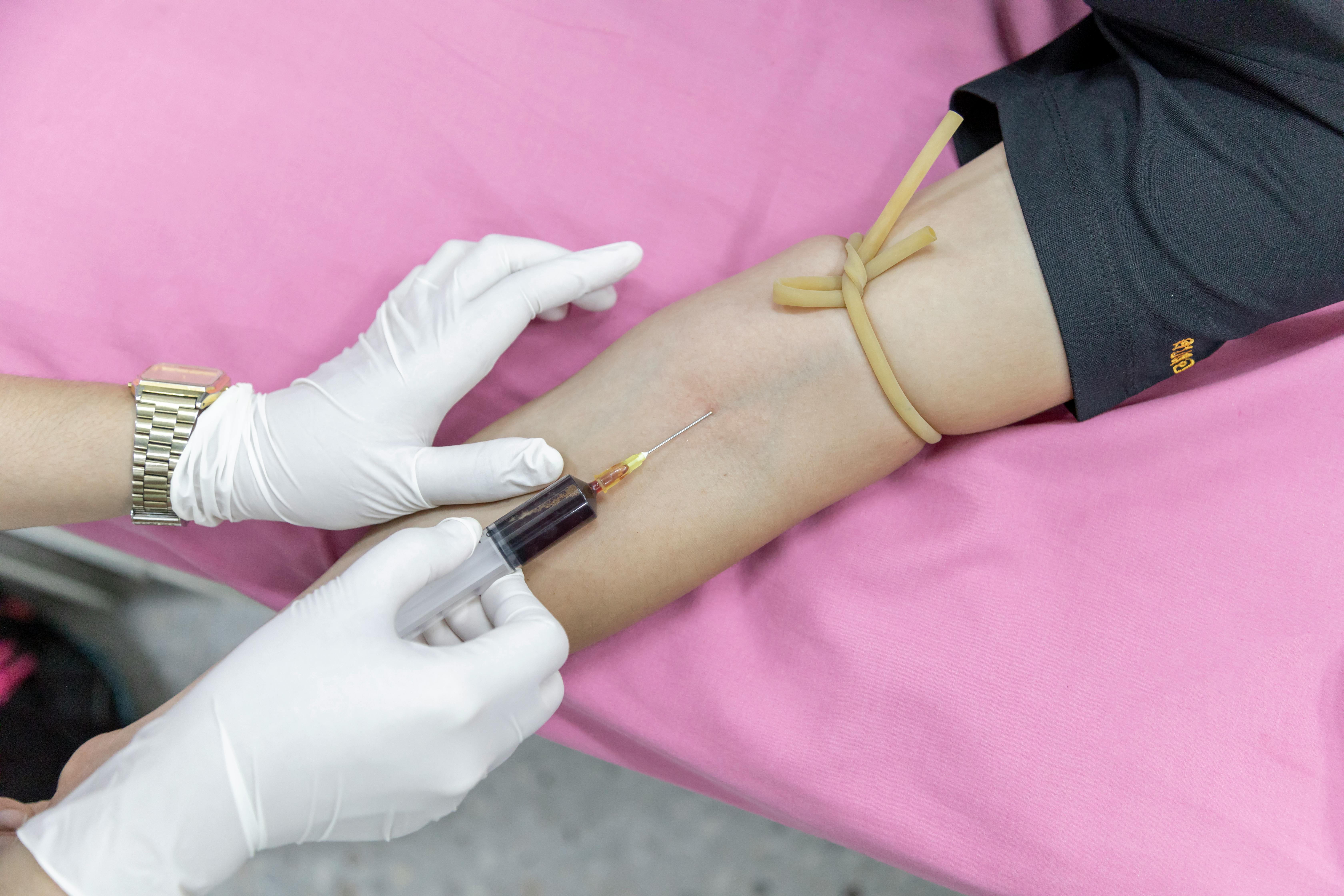 Free stock photo of arm, blood, glove