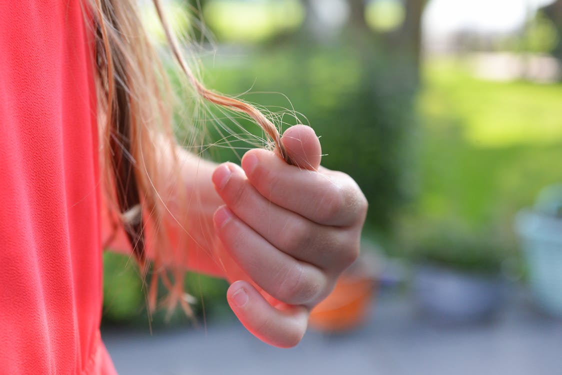 Alopecia in Women