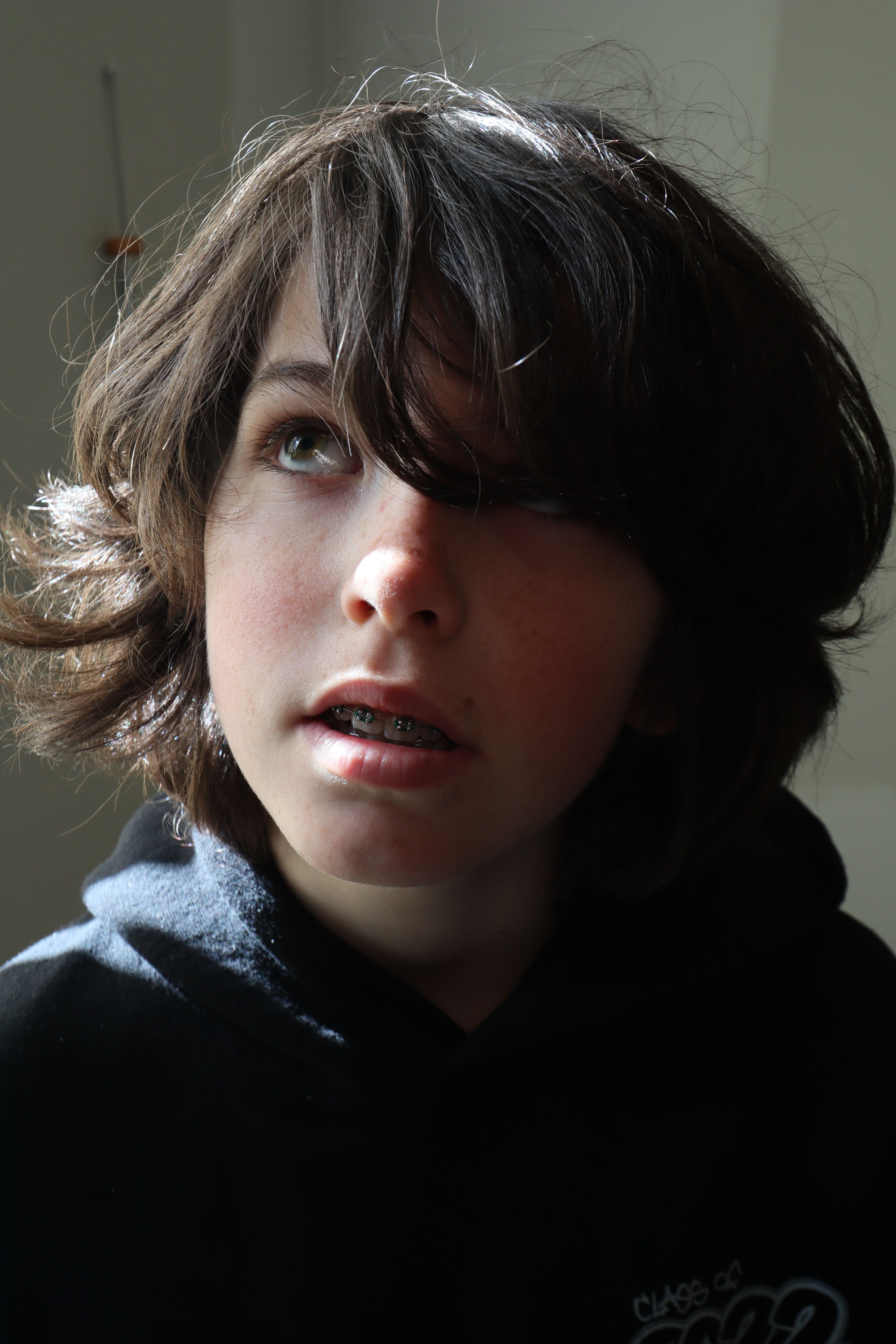 Close-up portrait of a teenager with braces gazing upwards in contemplation.