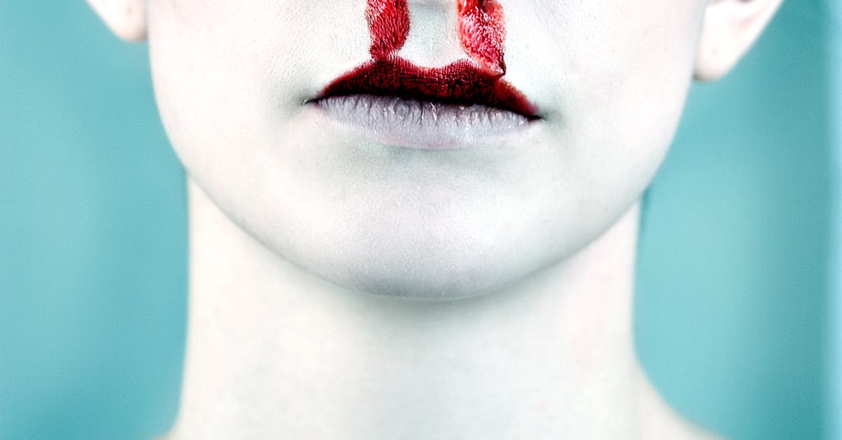 How to stop tongue bleeding when on blood thinners