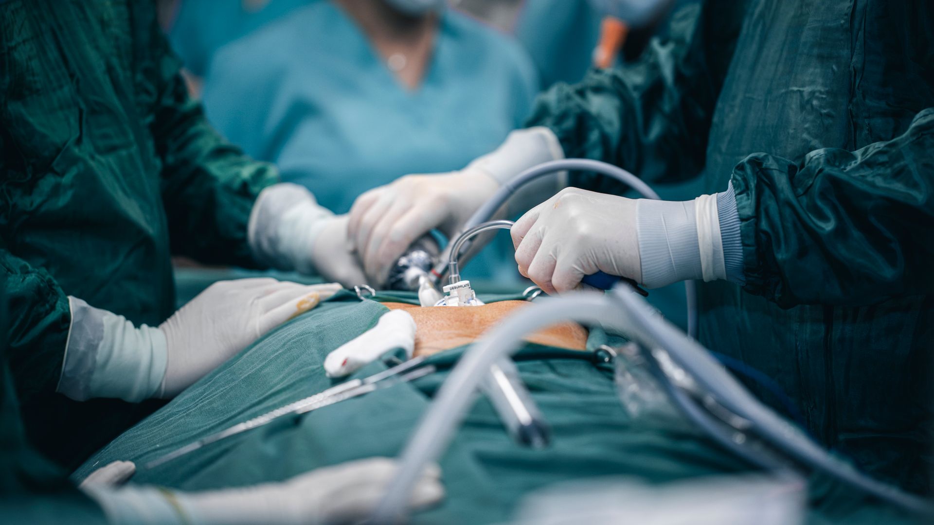 Modafinil for Surgeons: A Game-Changer in the Operating Room A detailed view of surgeons in action during an operation, highlighting surgical precision — modafinil for surgeons
