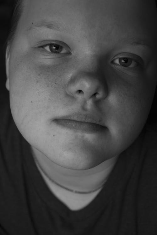 Grayscale Photo of Woman's Face with Freckles