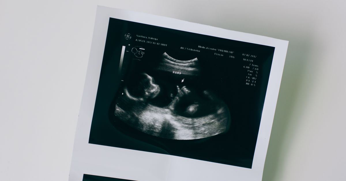 Close-Up Shot of a Sonogram · Free Stock Photo