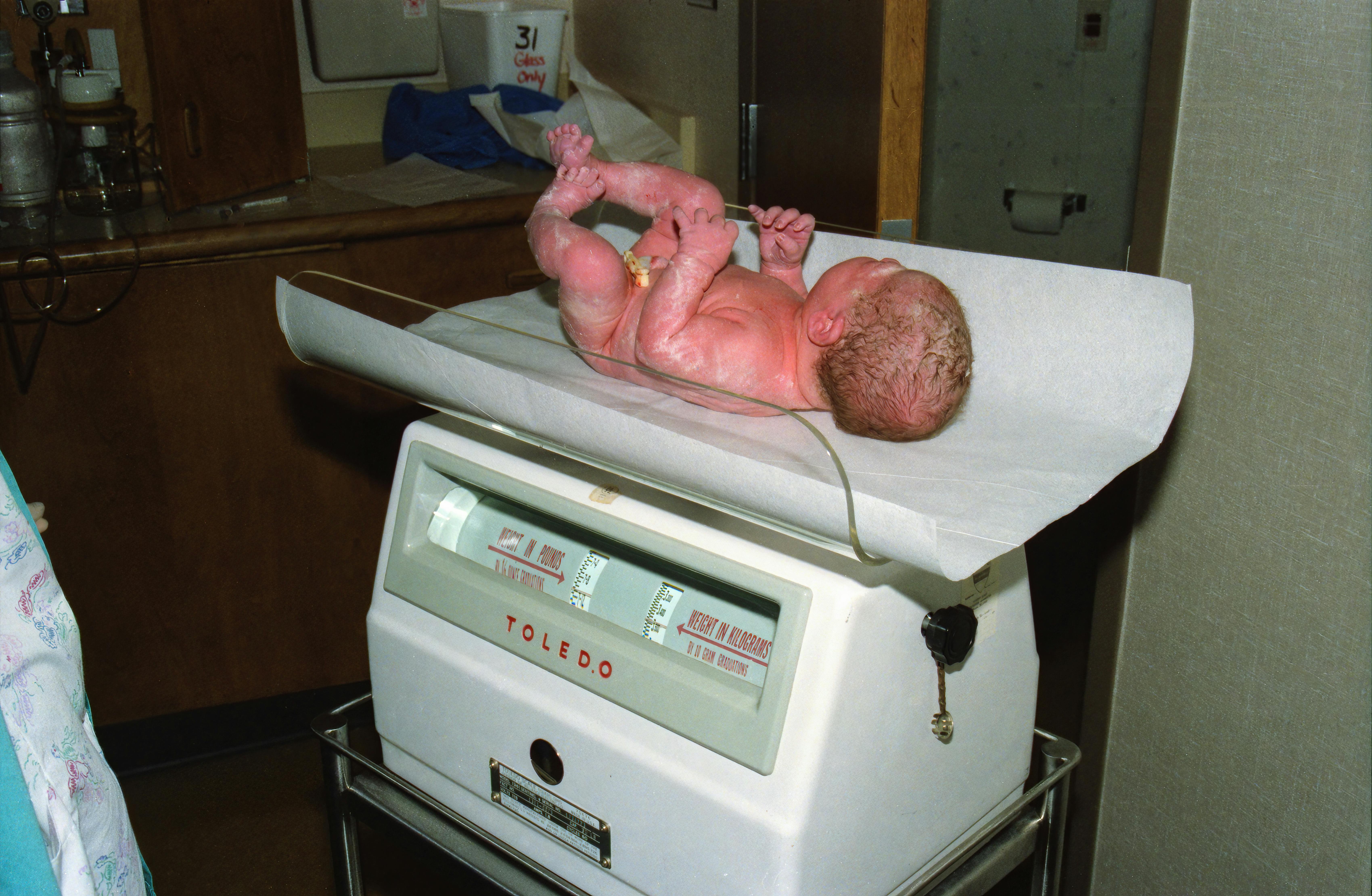 Newborn baby being weighed on a hospital scale, documenting the first moments of life.
