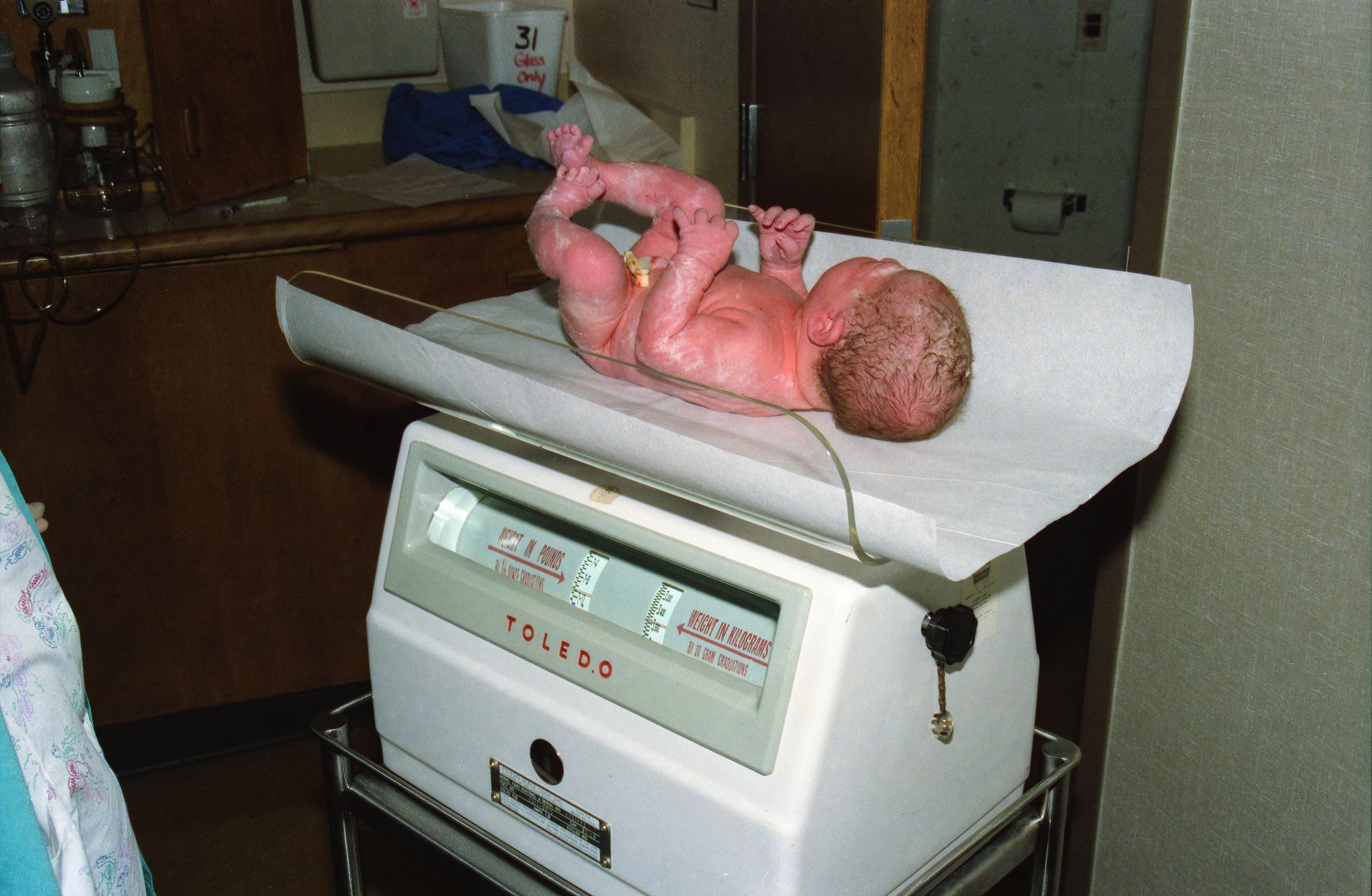Perinatal Stroke: Understanding Brain Injury in Newborns