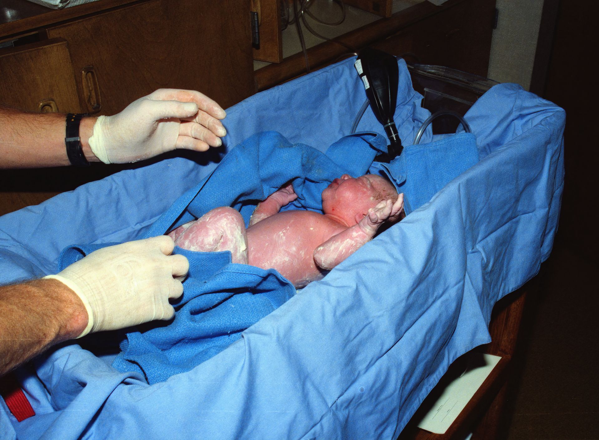 Newborn baby receiving medical care in a hospital cradle after birth.