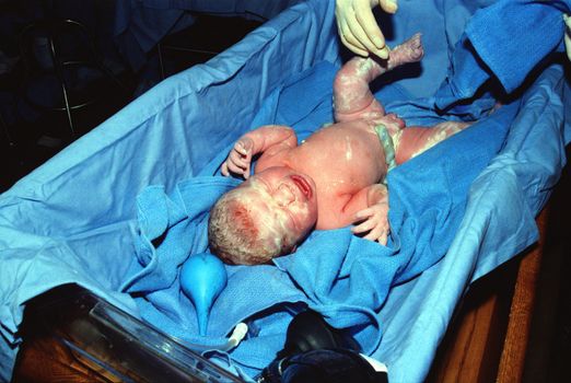 A Crying Newborn Baby
