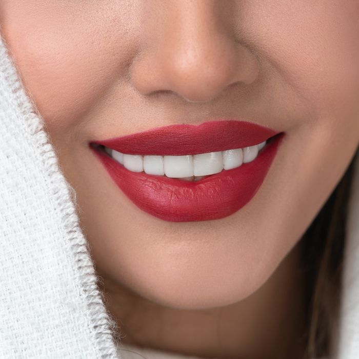 Resultado de tratamiento dental: sonrisa sana