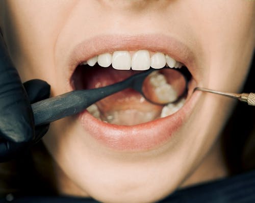 무료 치과 의사 Washington Heights   Esthetix Dentist, Nyc의 치과 임플란트 및 미용 전문가 스톡 사진