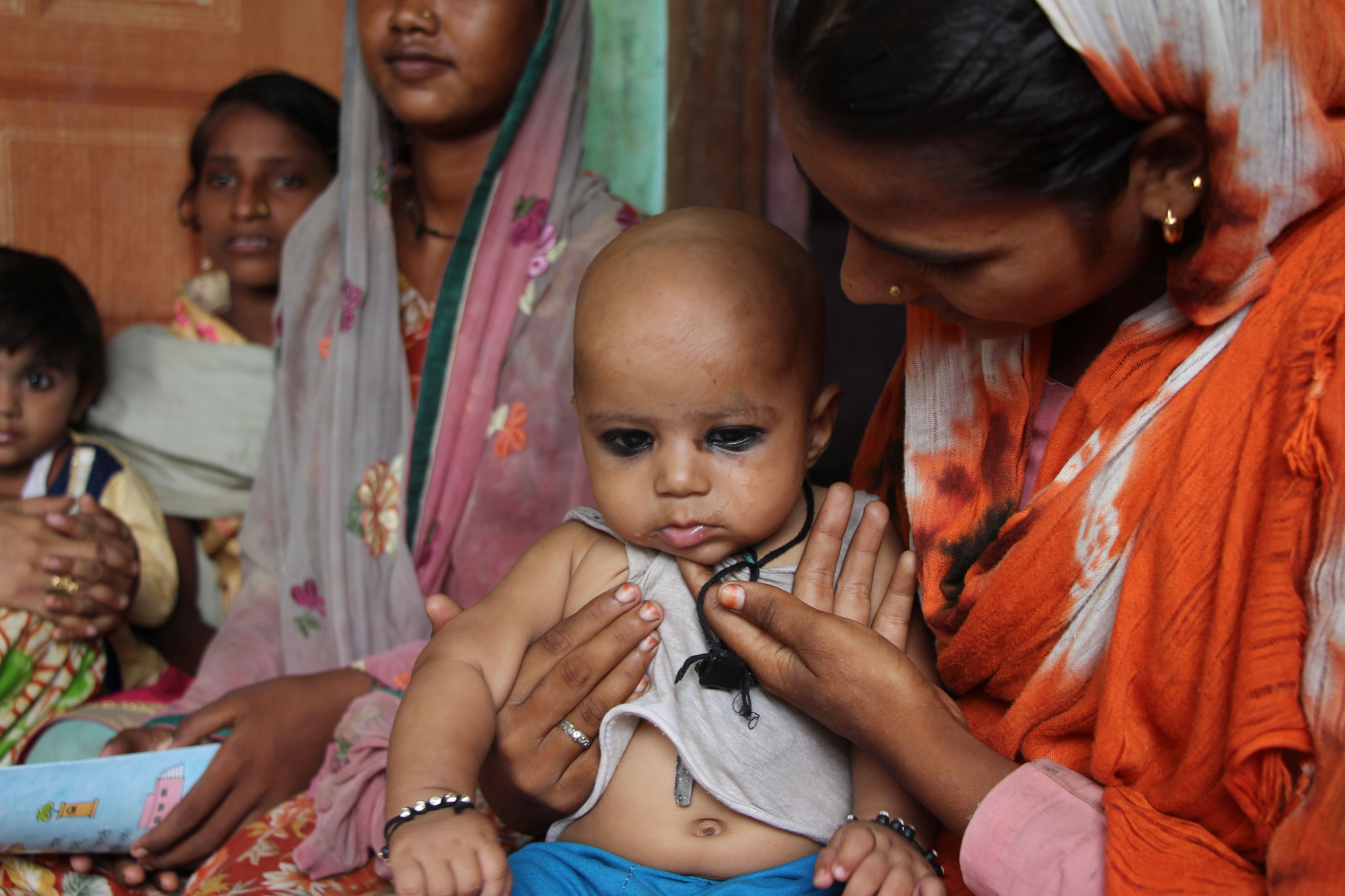Who Is Vulnerable to Severe Dengue
