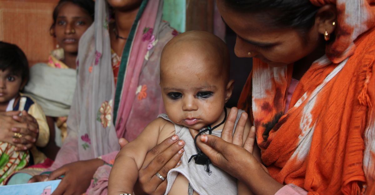 Who Is Vulnerable to Severe Dengue