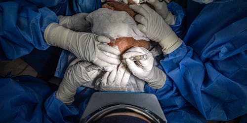 Surgeons Performing a Surgical Procedure 