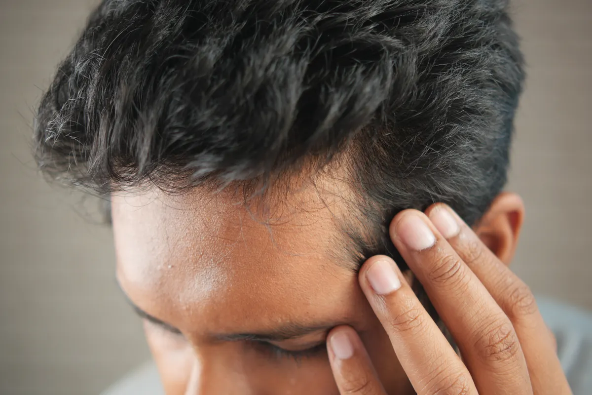 Can Stem Cell Microneedle Patches Solve Hair Loss?