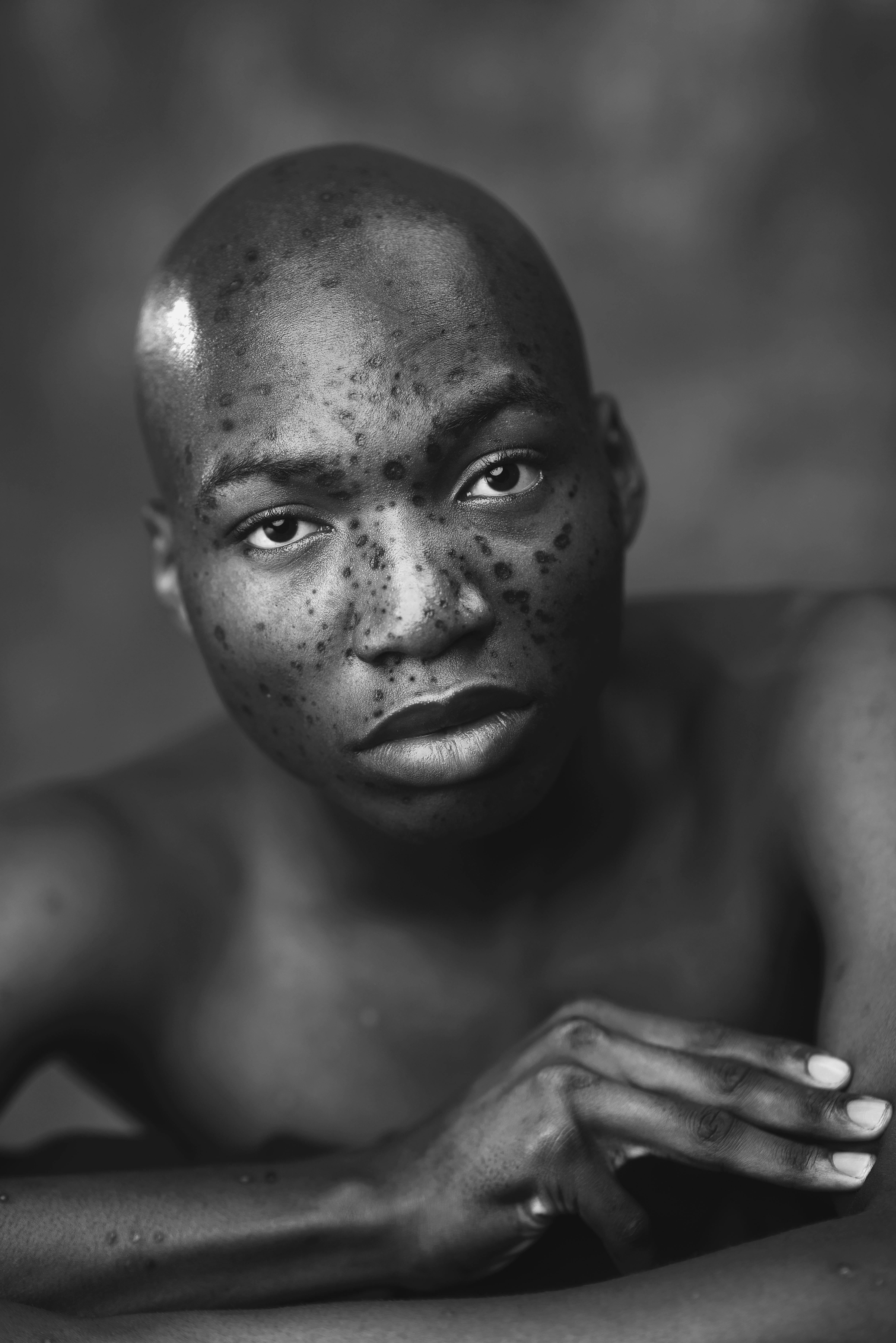 Striking black and white portrait of a young freckled man with intense gaze in a studio setting.