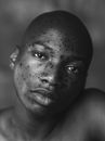 Black and White Portrait of a Shirtless Man with Freckles 